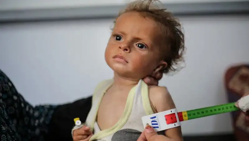 İngiltere, Gazzeli Çocuklara Umut Oluyor: 300 Çocuğa Kapılar Açılıyor