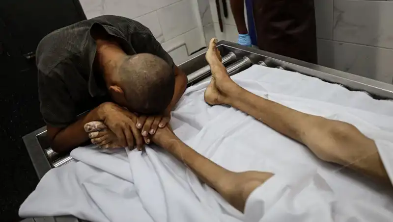 Gazze'de Açlık Korkunç Boyutlara Ulaşıyor, Bir Çocuk Daha Hayata Veda Etti